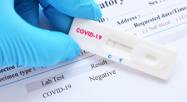 COVID-19 test is compulsory